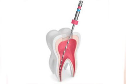 endodonzia