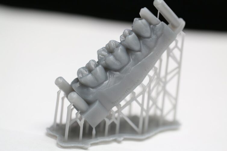 3d printed model dentist putignano luciani